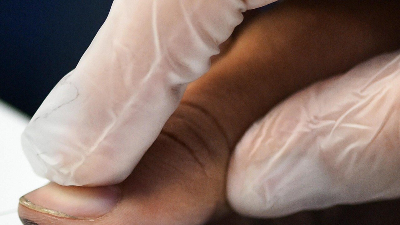 Estradato un broker della droga, si era alterato le impronte digitali